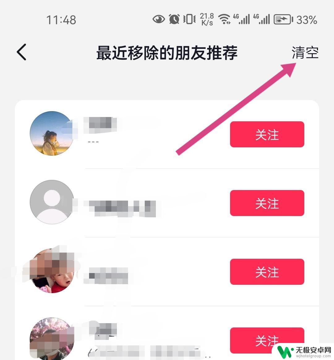 抖音里移除的朋友推荐怎么删除 最近移除的朋友推荐怎么删除